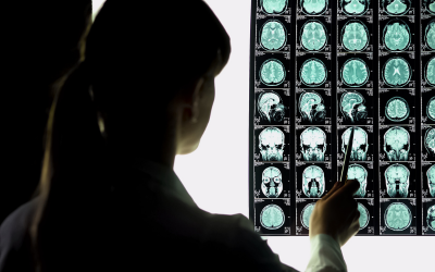 Endovascular Neurosurgery - Mindspine