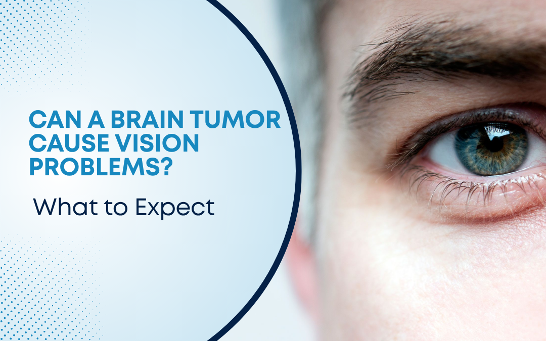 Can a Brain Tumor Cause Vision Problems?